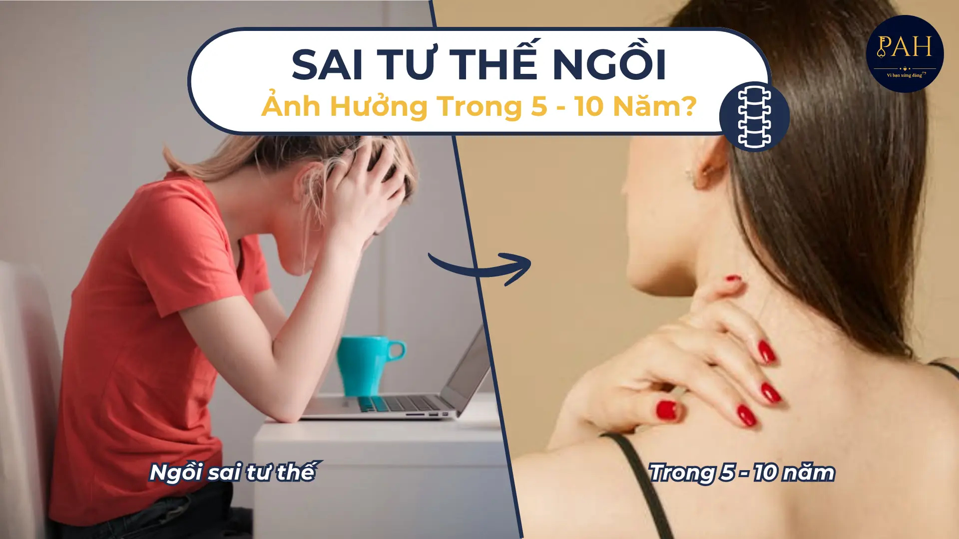 Sai Tư Thế Ngồi Ảnh Hưởng Như Thế Nào Trong 5 - 10 Năm?