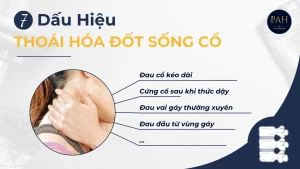 7 dấu hiệu thoái hóa đốt sống cổ bạn không nên bỏ qua