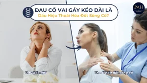 Đau Cổ Vai Gáy Kéo Dài Là Dấu Hiệu Thoái Hóa Đốt Sống Cổ?