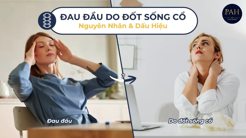Đau Đầu Do Đốt Sống Cổ: Nguyên Nhân Và Dấu Hiệu